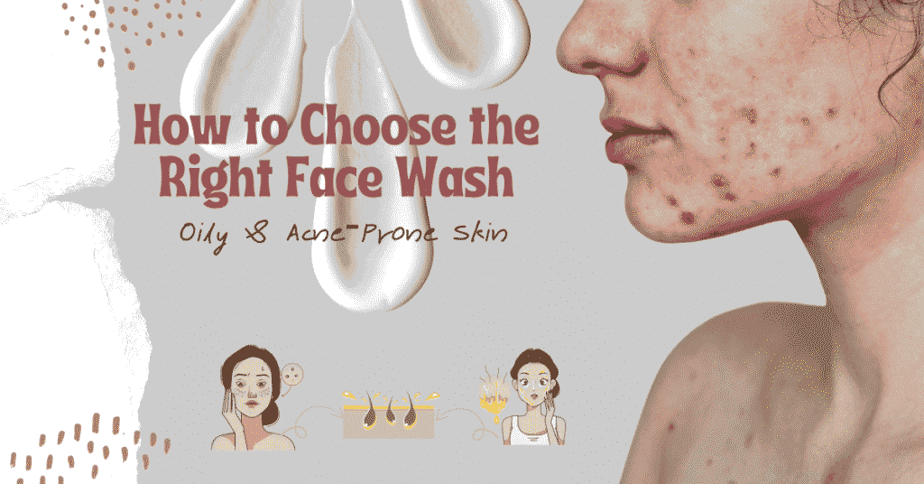 How to Choose the Right Face Wash for oily and acne prone skin